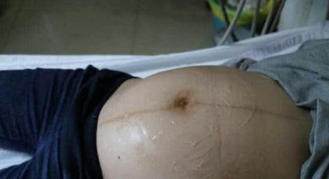 产妇|产检做B超时,医生涂抹的“透明液体”究竟是啥?多数人不知道