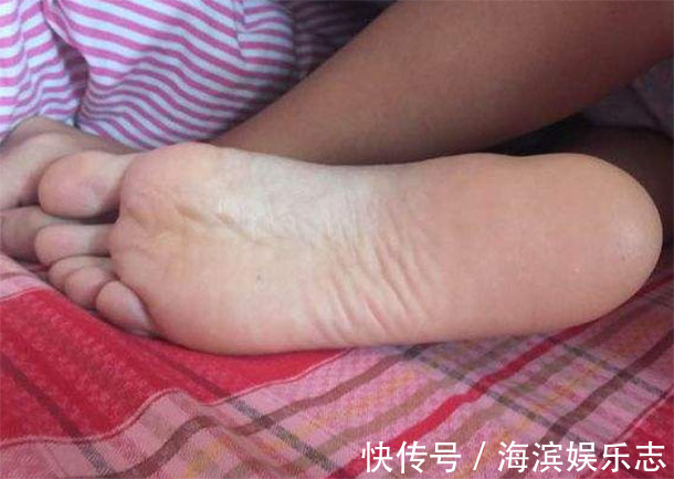 脚部|脚部出现“3迹象”，说明肝脏已“烂成渣”，为了健康要了解