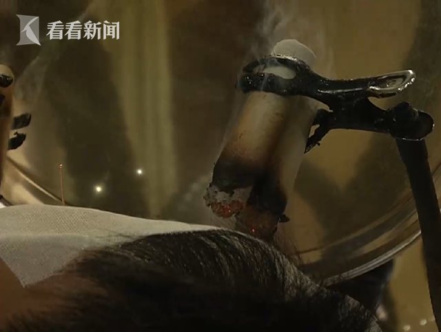 针灸科|空调、电扇轮番猛吹 小伙“眼歪嘴斜”进了医院