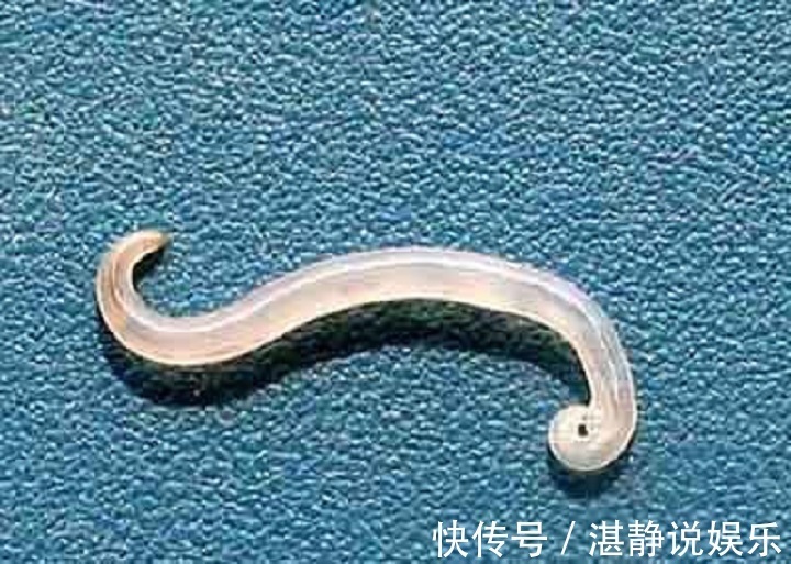 小晴|8岁男孩肝脏长满虫子!医生不要给孩子买这些食物,寄生虫太多