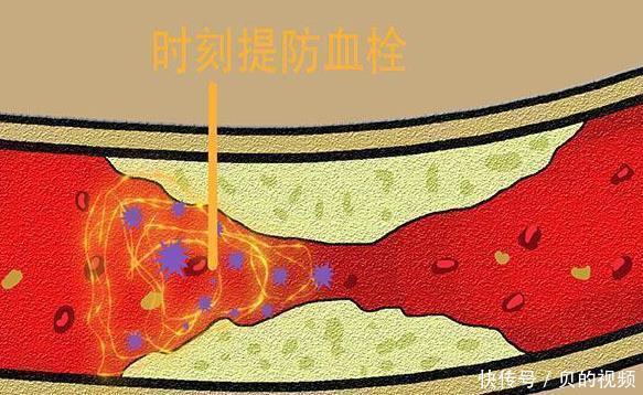 开关|脚上有一个“化血栓开关”,睡前按一按,有效清血毒,防血栓