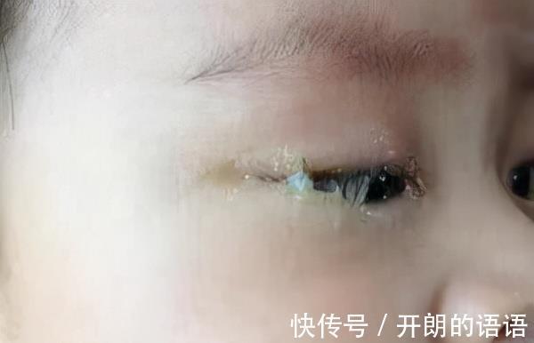 棉球|奶奶用“土方子”给刚出生的娃洗眼睛,养娃还是要按科学的方法来