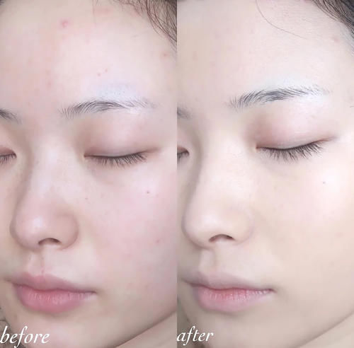 干皮“公认”好用的3款粉底液，妆感清透又持久