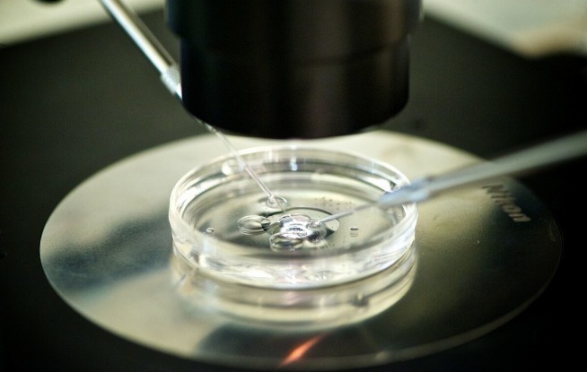 玻璃器皿|试管婴儿取卵会很痛取完之后是什么情况呢