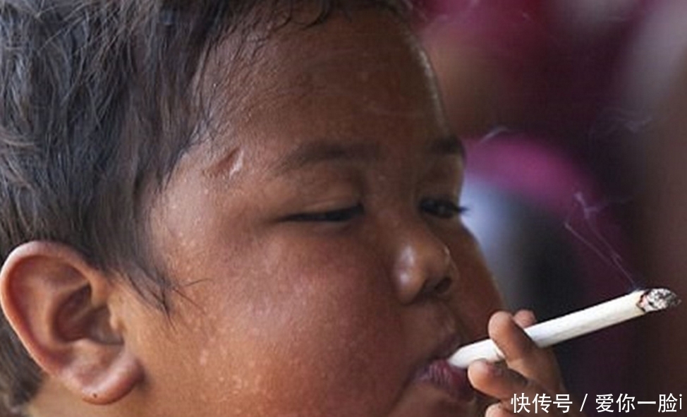 印尼|印尼2岁小孩每天抽40根香烟,6年后的他是怎样的?