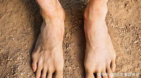 不错|如果你的脚上没有这些“表现”,恭喜,你的肾脏保养的还不错