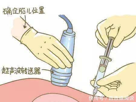 产检|怀孕40周做十多次产检都有必要吗？四项产检认真做，关乎胎儿健康