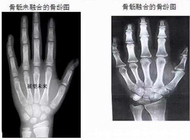 垃圾食品|男童被家人喂到停止发育!医生怒斥:你竟敢给娃吃这个?