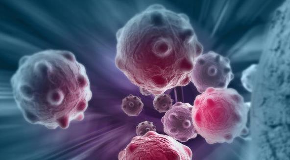 癌症|被“骗了”100余年，原来癌症不是要命的疾病，看到就是赚到