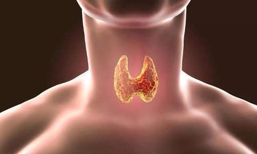 分化型|20多岁得甲状腺癌能活50年吗，医生：注意4件事，可能会活的更久