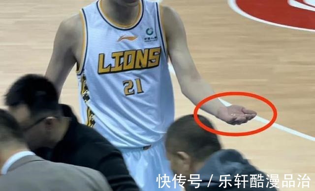 广东男篮|赵岩昊的牙,被打掉两颗,广东男篮两场比赛,伤了6名国家队队员