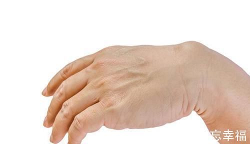 眩晕|引发中风的4个诱因,需留意!中风来临前,身体会发出4个信号!