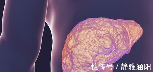 养肝排毒|5种食物是肝脏的“解毒王”,生活中常吃,疏肝排毒、肝脏更健康