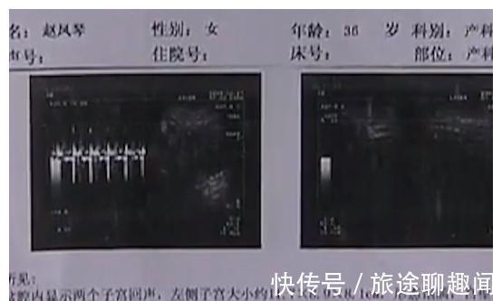 医生|结婚十年终于怀孕，为何怀孕5个月时胎儿凭空消失，事情并不简单