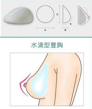 切口|济南海峡整形分享：关于隆胸你要了解的事