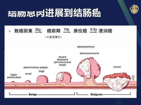 恶性肿瘤|厦门一男子突然大量便血，一查竟是癌症！医生：这种病早期易被忽视