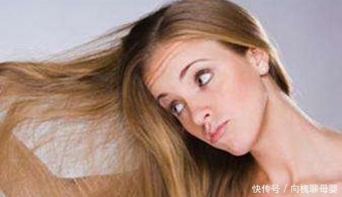 头皮屑|最近老是头油头屑多,你需要找到原因所在,3个方法快速去油去屑