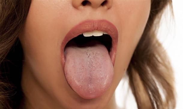  症状|脑梗有什么症状？若有3个部位发麻，或是在暗示脑梗的到来