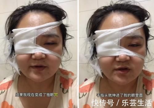 敏感期|剖腹七层生下你,你却让我变“独眼”,宝妈:别让孩子伤害了你