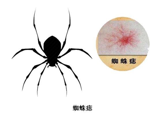 先知|肝不好,皮肤先知?皮肤出现4个标志,或是肝病拜访,要及时养肝