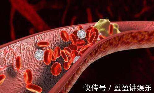 疏通血管|它是血管“清洁工”，坚持每天吃一点，助疏通血管，身体健康