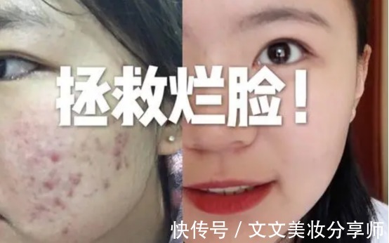 护肤品|慎用!这些护肤品皮肤科医生都不用,直接进入“拒用榜”无人问津