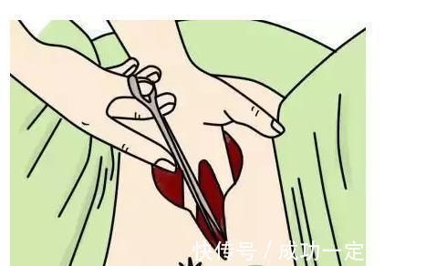 医生|孕妇须知:顺产侧切后,缝针会不会很疼?答案跟你想的不一样