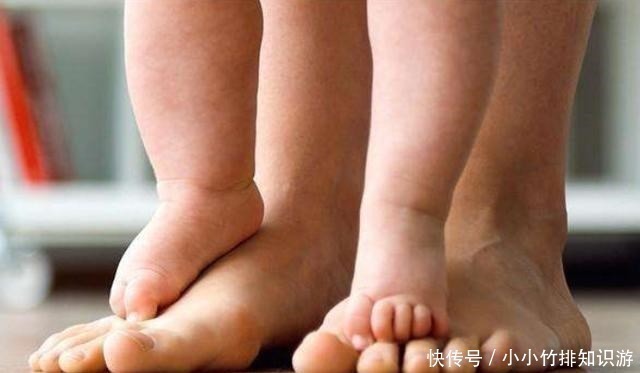 田亮|孩子腿部出现2个“特点”,长大多半是高个子,你家孩子有没有