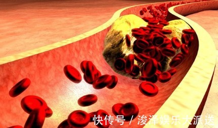 血脂|男子血脂10.8!仅2个月,血脂恢复正常!降血脂冠军是什么