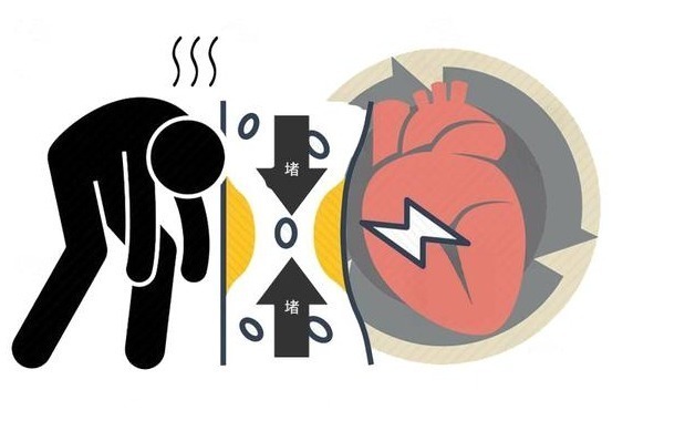 便秘|经常便秘要注意,3个危害在所难免,巧用3个方法,或许可以改善