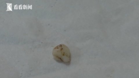 有异物?年初一吃面硌了牙 女子一看直呼:恶心