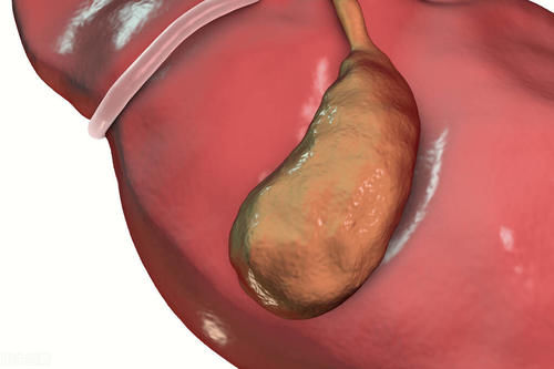 胆囊炎都有哪些症状 其诱因有哪些 如何治疗 医生告诉你 快资讯