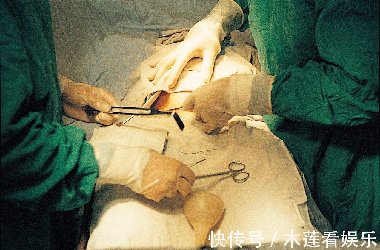 松解术|第一次剖腹产和第二次剖有啥区别医生同样是剖，区别却很大