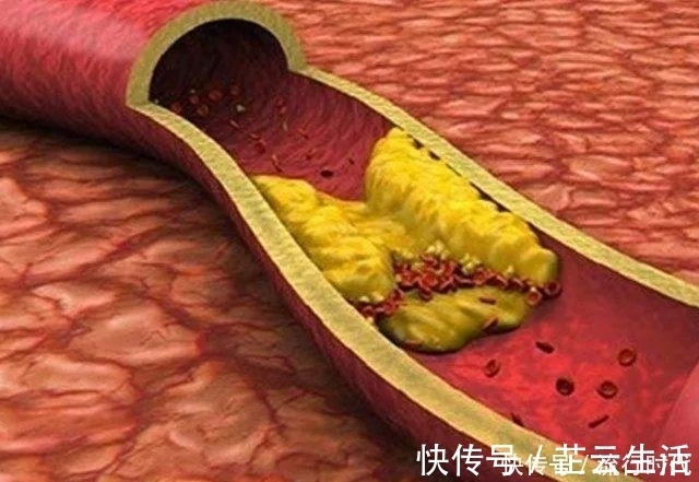 胆固醇|有种食物每天吃几个好处多多,防血栓、抗衰老、身体越来越健康