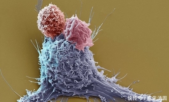 不妨|决明子配“它”,肝脏“保护伞”,老中医:不妨多喝!