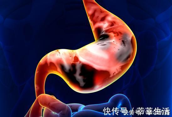 肝气郁结|消化科专家养胃很简单，多喝一水，胃会慢慢变好，清除幽门菌