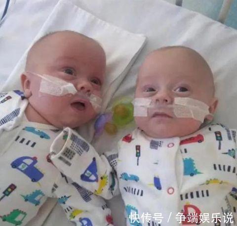 双胞胎|世界最小的双胞胎男孩,怀孕23周出生,只有手掌大小却奇迹存活
