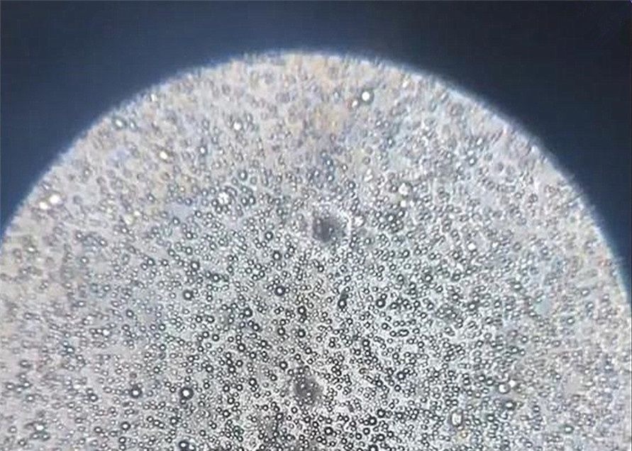 白细胞|将母乳放大1000倍是什么样显微镜下的图片，当妈的都该看看