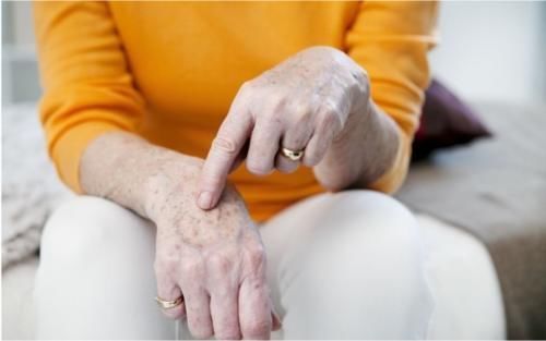 身体健康|为什么出现老年斑?是身体健康发出的信号?做好4事,远离色素斑