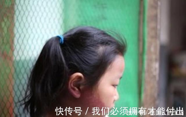 化学物质|孕妈在孕期,尽量不做4件事,避免宝宝脸上长胎记,孕妈别不在意