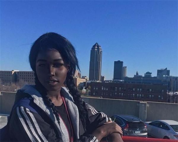 她是“最美黑人女孩”,因长得太漂亮,家人从不敢让她单独外出