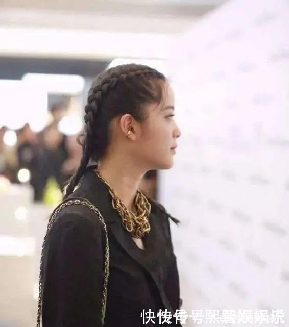 蒜头鼻|五种公认的“丑鼻型”，蒜头鼻、驼峰鼻都上榜了，第一个最常见