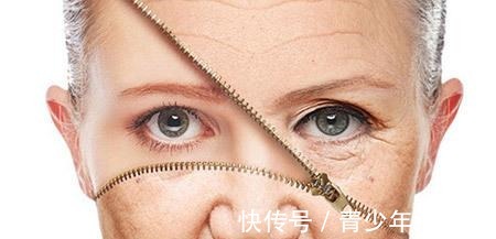 拉皮 小拉皮术后6个月,让她从老阿姨逆袭小姐姐!