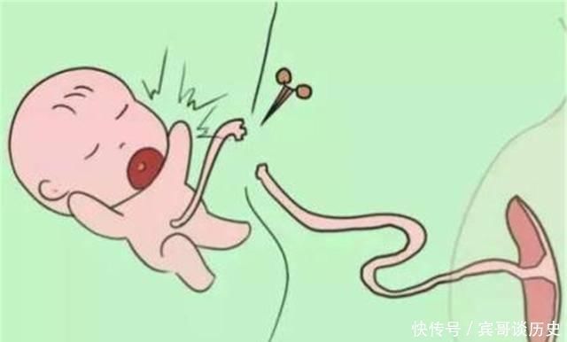 宝妈|胎儿出生“剪脐带”时,是妈妈痛还是胎儿痛答案有点意外