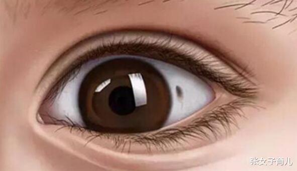 医生|3岁宝宝眼白出现黑点,怎么回事儿听了医生的答案,终于放心了