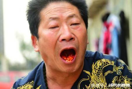 一天吃5斤的中国辣王,曾把辣椒当饭吃,如今怎么样了