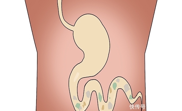 为什么有人会经常放屁?放屁次数过多,和哪些因素有关?