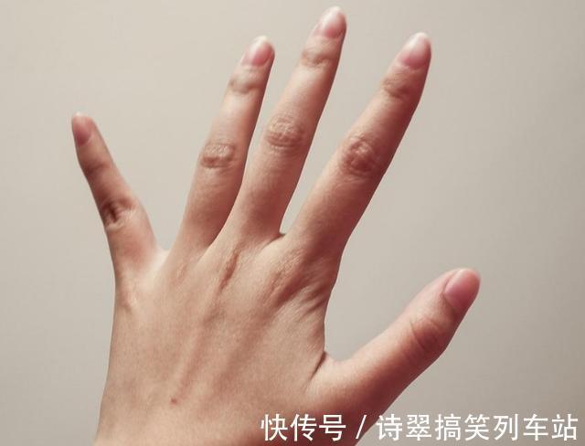 紫菜|血糖高不高,看双手就懂?若有这4种症状,或在暗示血糖偏高了