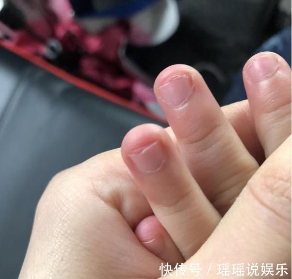 指甲|研究发现:爱咬指甲的孩子,都逃不过这5种结局!