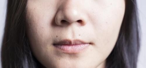 妇科病|女人有没有妇科病，看嘴就能明白，若有表现，十有八九是找上你了